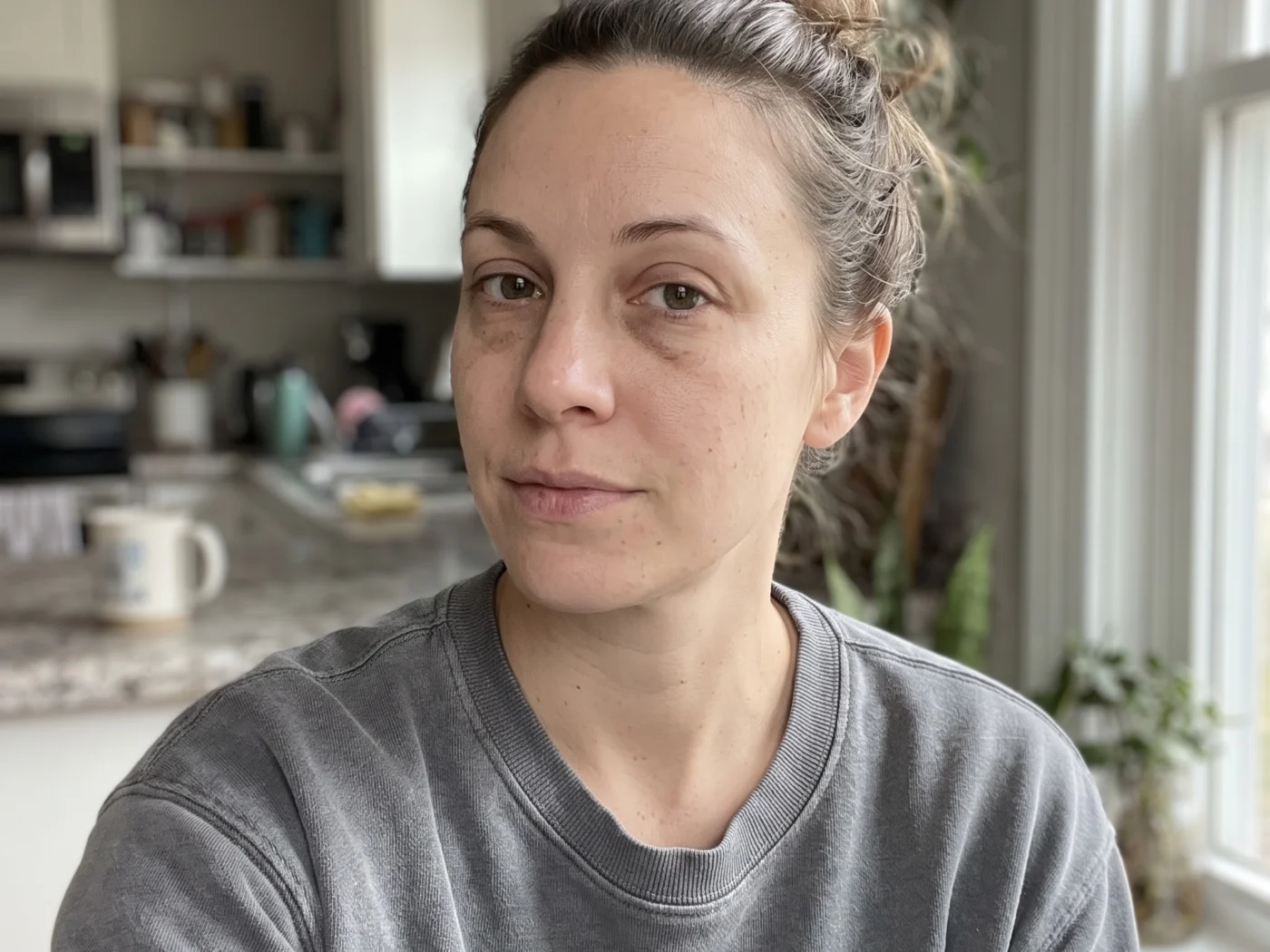 How to Get Rid of Dark Circles Under Eyes Naturally